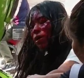 Brutal & Bloody Girl Fight.