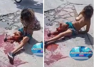 Chick with Leg Ripped off Decides its a Good time to Strip.