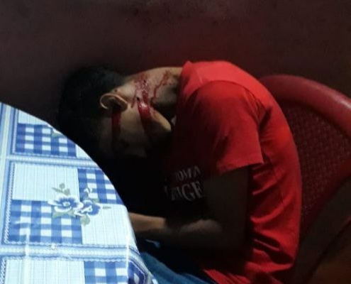 Young man enjoying his beer executed by sicario 