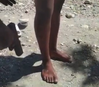 Gang Member Gets Shot In Both Feet