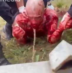 A Drug addict in Russia Continuation (Pt2).