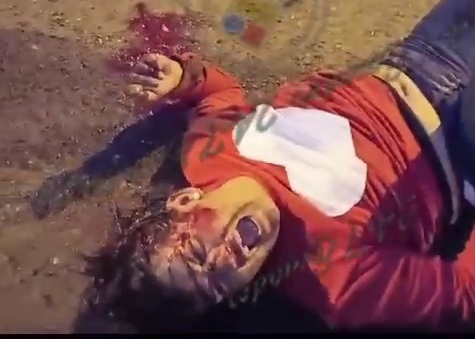 Woman leg horrifically crushed after two motorcycle collision 