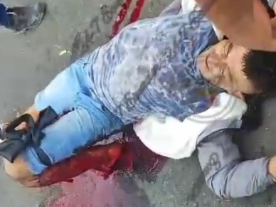 Strong traffic accident leave motorcyclist with crashed leg