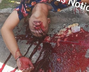 Young man executed by sicario with shoot in the face 