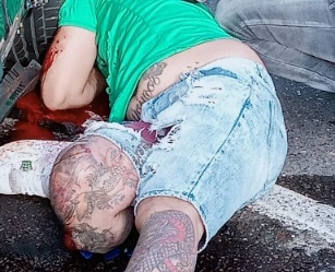 Motorcyclist in agony with his leg twisted after motorcycle accident 