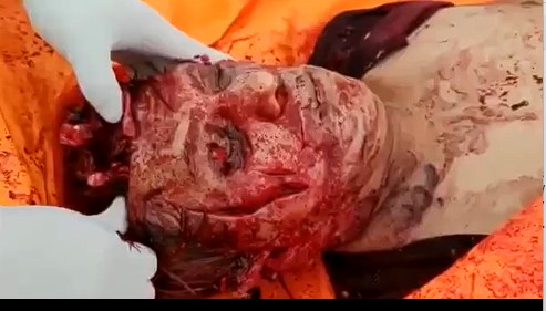 autopsy of a brutally murdered woman