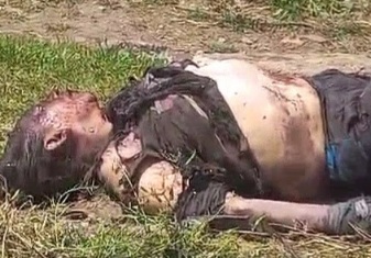 Victime burned after small factory explosion 