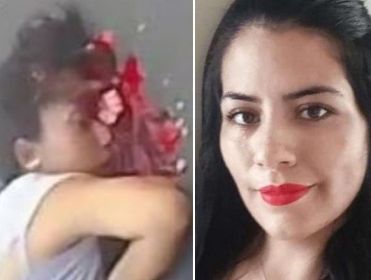 [BRAIN ON THE ASPHALT] Woman on Motorcycle Crashed Dead 