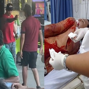 Drunken Bar Fight Kicked Up a Notch With a Knife