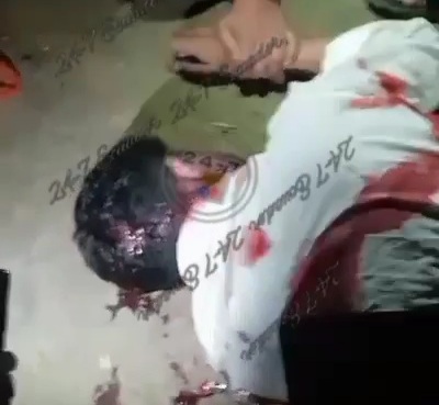 Headshot from sicario ended the life of young man 