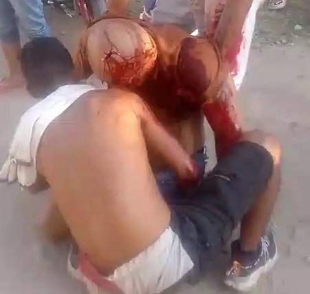 Man shoot in the head by sicario 