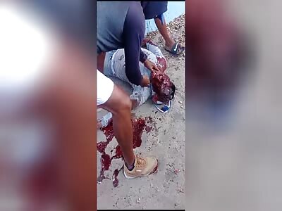 Hitmen burst a citizen's head with several shots