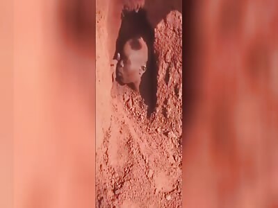 Congolese miner luckily survived a landslide.