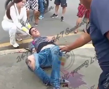 Young man crashed his leg in brutal motorcycle accident 