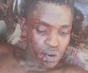 Wounded gang member dumped in the back of truck 