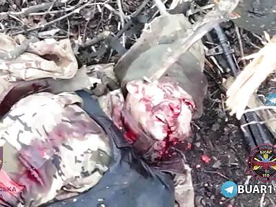 Meat grinder near Avdiivka (Graphic!)