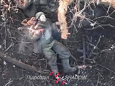 Russian loses his wrist