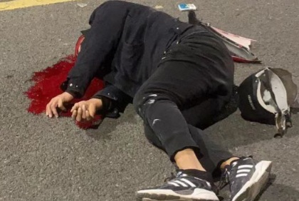 Motorcyclist head crashed after a deadly accident 