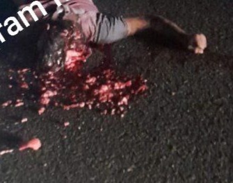 [BRAIN ON THE ASPHALT]MOTORCYCLIST SKULL CRASHED 