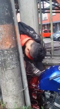Biker Bleeding Horribly on the Corner of a Lamppost.