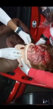 blonde woman victim of a serious accident