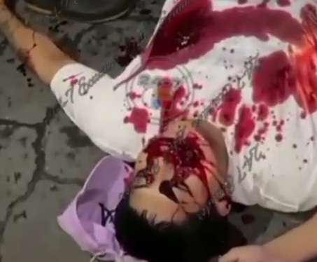 Sicario Shooting one person was KILLED and another SERIOUSLY INJURED 