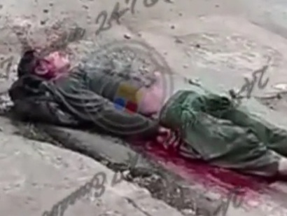 person injured with multiple machete cuts 