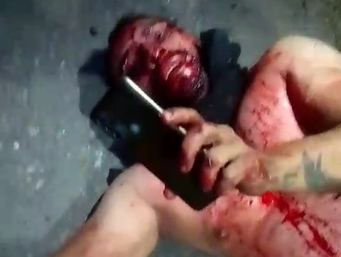 Colombian man stabbed and robbed by thieves 