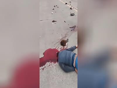 Accident in Philippines driver's head is flattened by truck