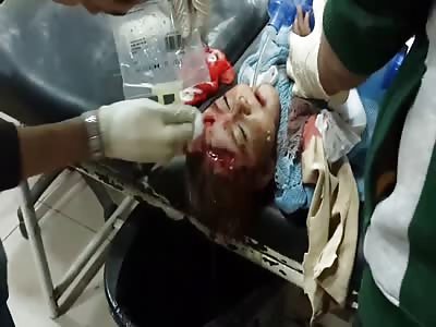 Medics try to help a little girl called Bayan as father wails in grief