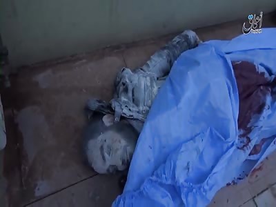 Massacre Commited By Crusader-led Coalition on a Mosul Hospital