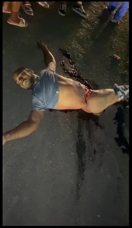 Brazilian man had his legs destroyed and dies