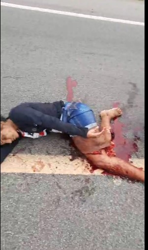 poor Brazilian woman thrown to the ground with her leg skinned