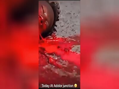 Man's insides spilling out of his mouth