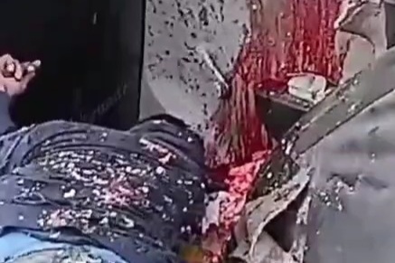 Horrific accident leaves taxi driver crashed in his car