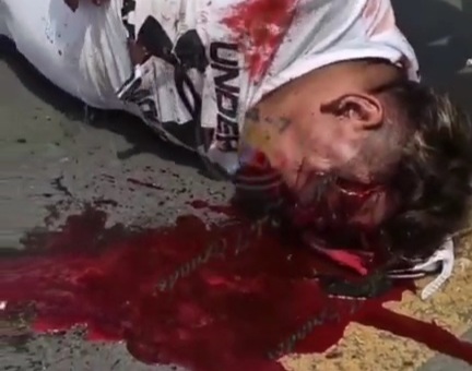 Horrific aftermath footage of motorcyclist crashed dead 