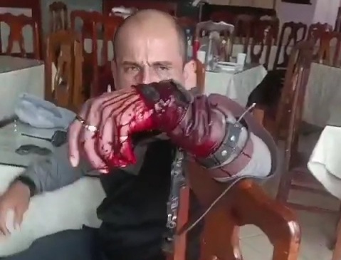 [ACTION AND AFTERMATH]security guard gets shoot during robbery 