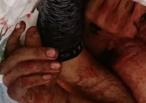 [HORRIFIC]TWO COMPLETELY DISMEMBERED BODIES in BAGS 