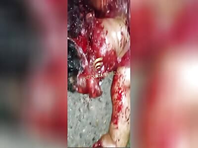 Woman's Face Brutally Chopped