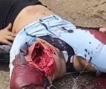 Couple on motorcycle crashed by truck husband dead wife badly wounded 