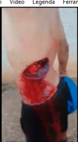 Wounded by a machete blow to the rib