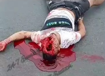 [Empty skull] HORRIFIC ACCIDENT LEAVES MAN WITH EMPTY SKULL 