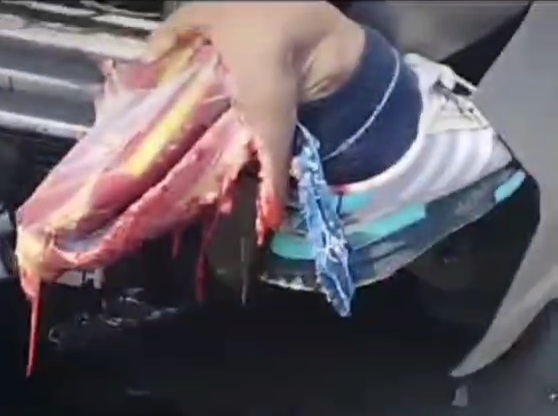 Man's foot severed in horrific motorcycle crash