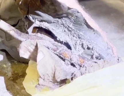  A Russian soldier's leg rots (gangrena) while he is still alive