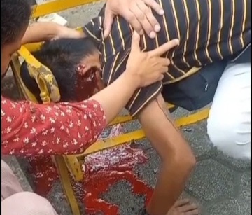 Another victim of Ecuadorian sicarios 