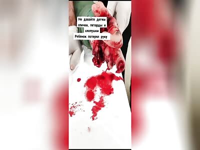 Boy tried to set off petard