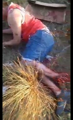 biker has his foot torn apart in accident