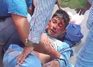 School boy on motorcycle crashed by taxi 