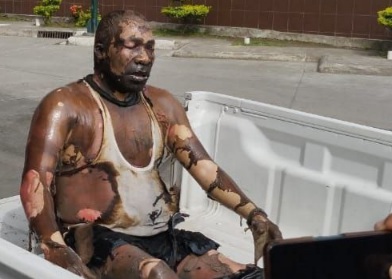 Driver trapped inside his burner car