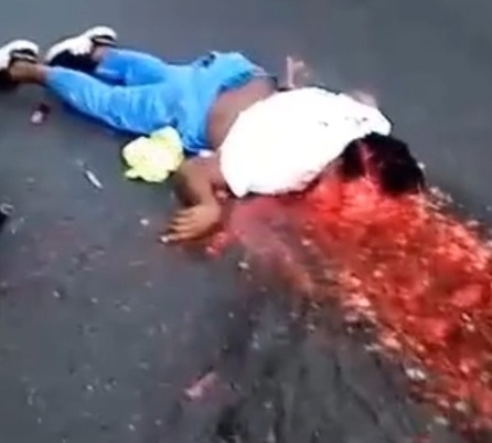 heart continues beating after brutal accident